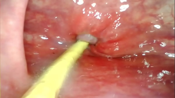 EXTREME ANAL POV. CAMERA INSIDE HER ASSHOLE AS I POUND HER WITH MY BIG COCK AND CUM DEEP INSIDE
